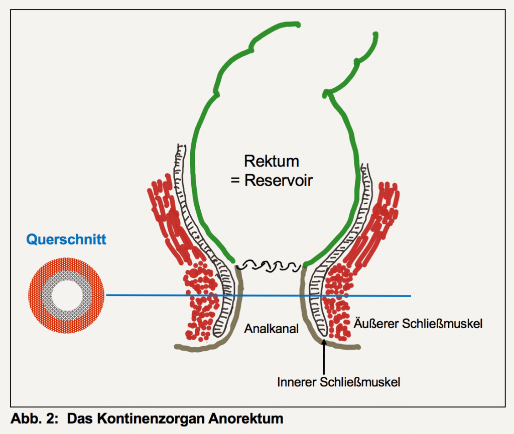 Stoma Rückoperation: Experteninterview - Physiotherapie Dr. Hochwimmer