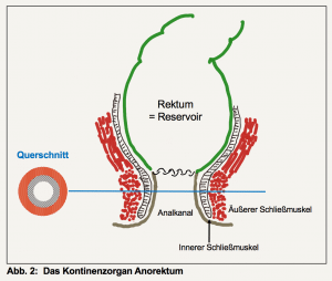 Rekrum vor Stoma Anlage